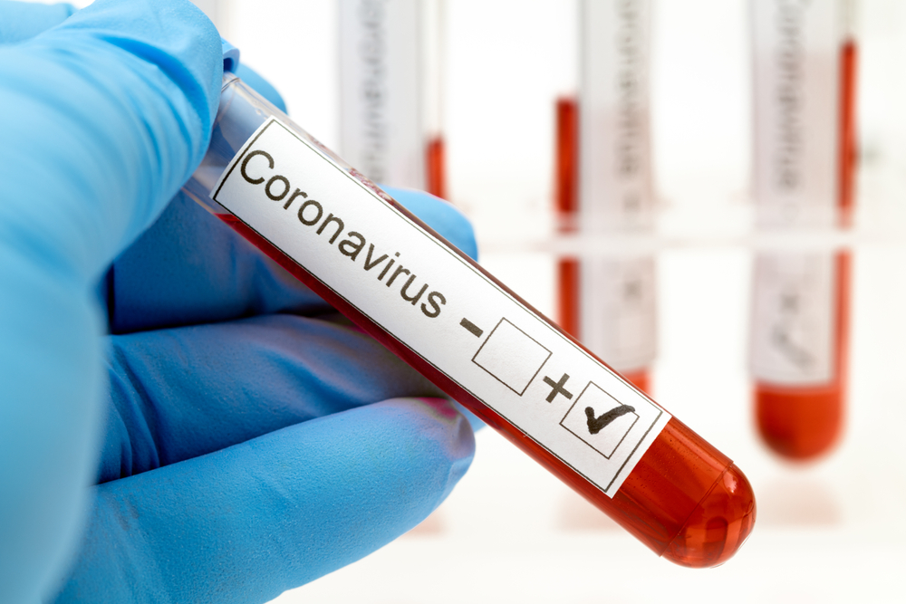 Protegerse del coronavirus